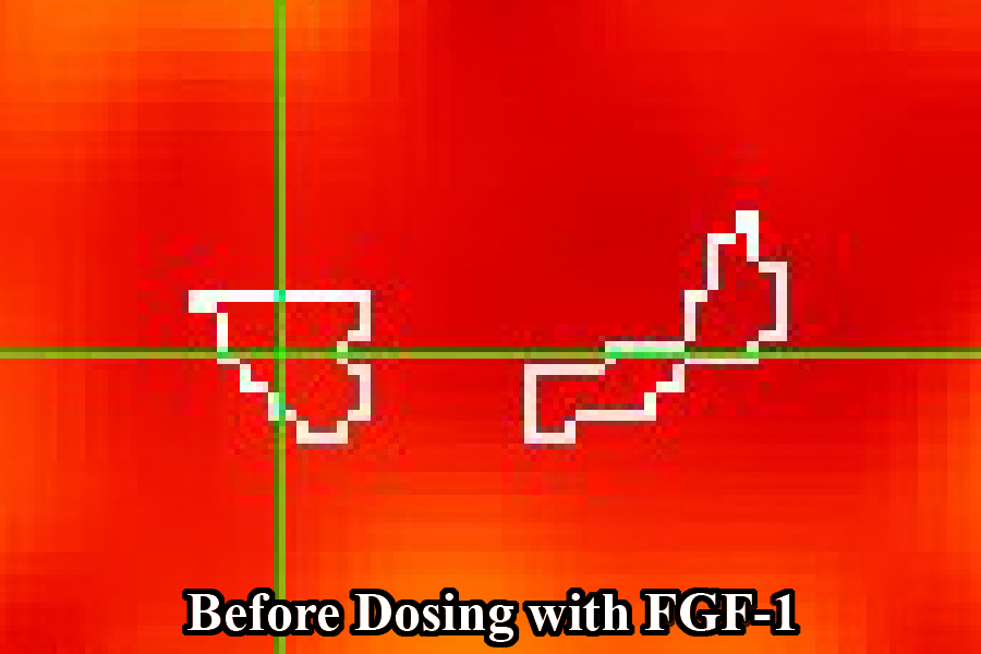 fMRI image of the substantia nigra region of participant Z101's brain before dosing. Most of the image is dark red.
